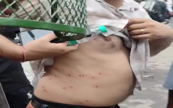 Reports Emerge Alleging Delhi Police Used Pellet Weapons Against Students During Protests; Home Ministry Faces Questions