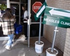 US surpasses 2025’s record number of measles infections as cases climb