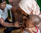 Children make up half of mpox cases in Guinea-Bissau as epidemic spreads