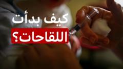 كيف نشأت فكرة اللقاحات؟ وهل فقدت الثقة بها مع مرور الوقت؟