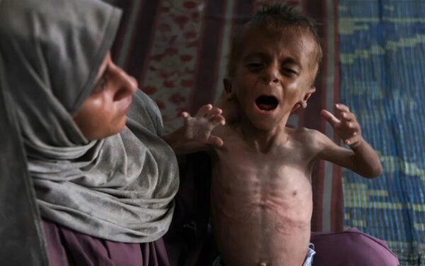 Gaza starvation: Why Israel's supporters are misrepresenting Unicef study